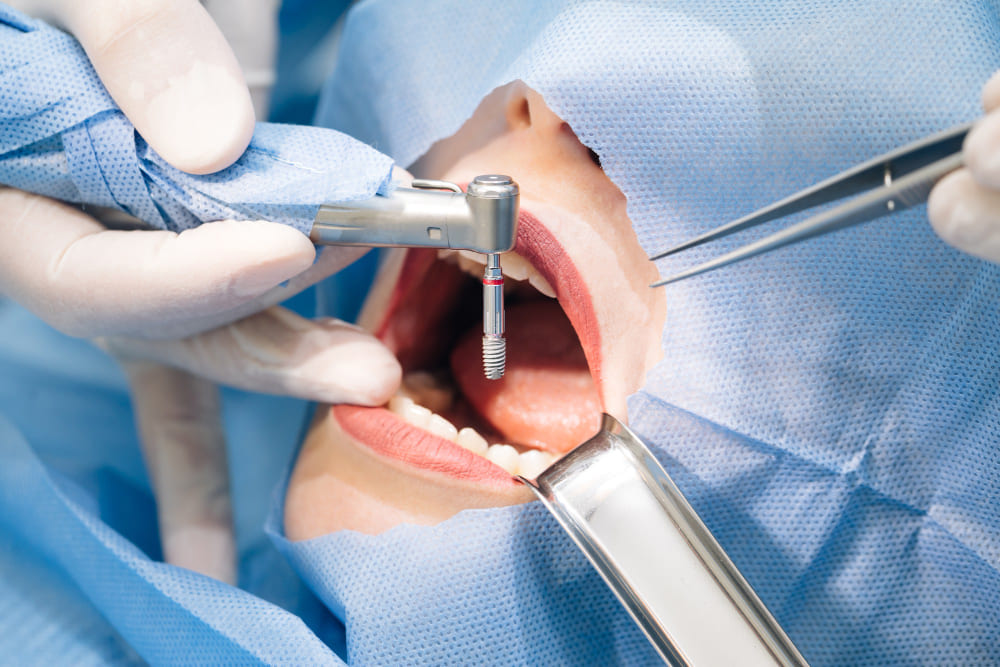 Estética dental en Xinzo de Limia. Dra. Yaima Ulloa. Clínica dental A Limia